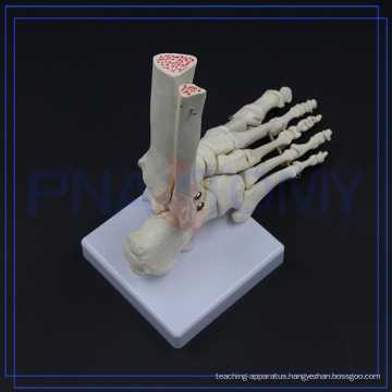 PNT-0109F Natural size human podarthrum skeleton medical model Foot Joint